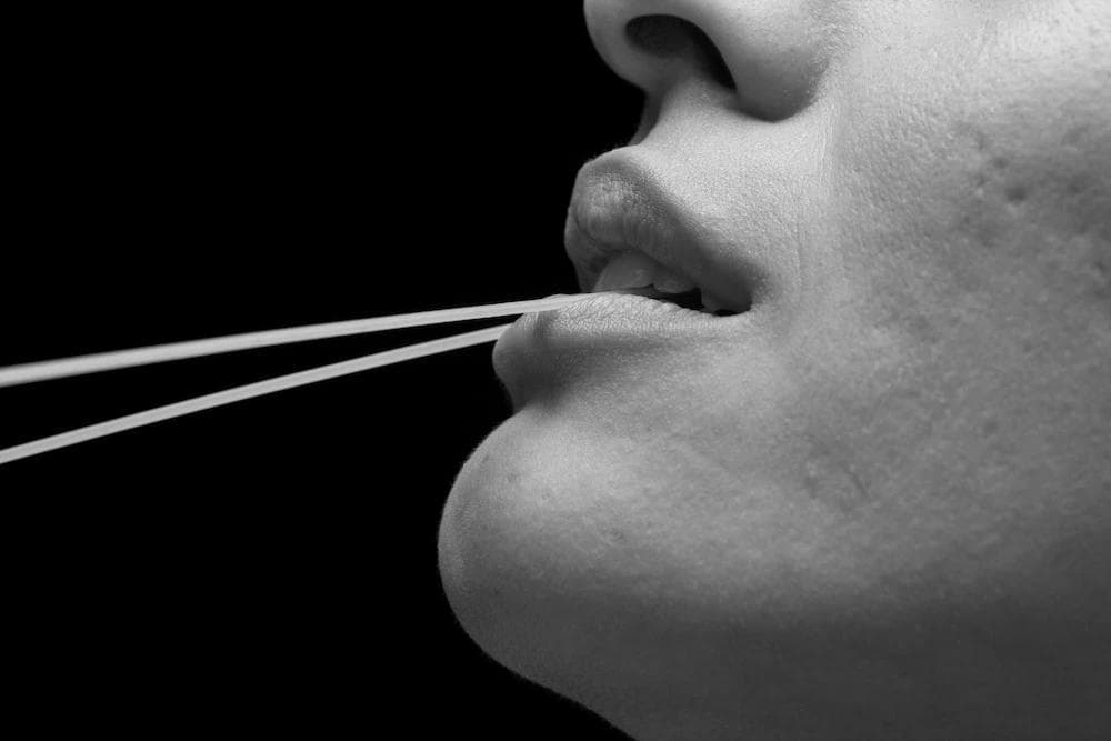 A woman in need of kybella treatment