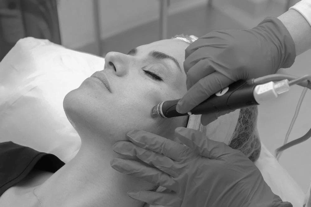 A woman undergoing hydrafacial treament